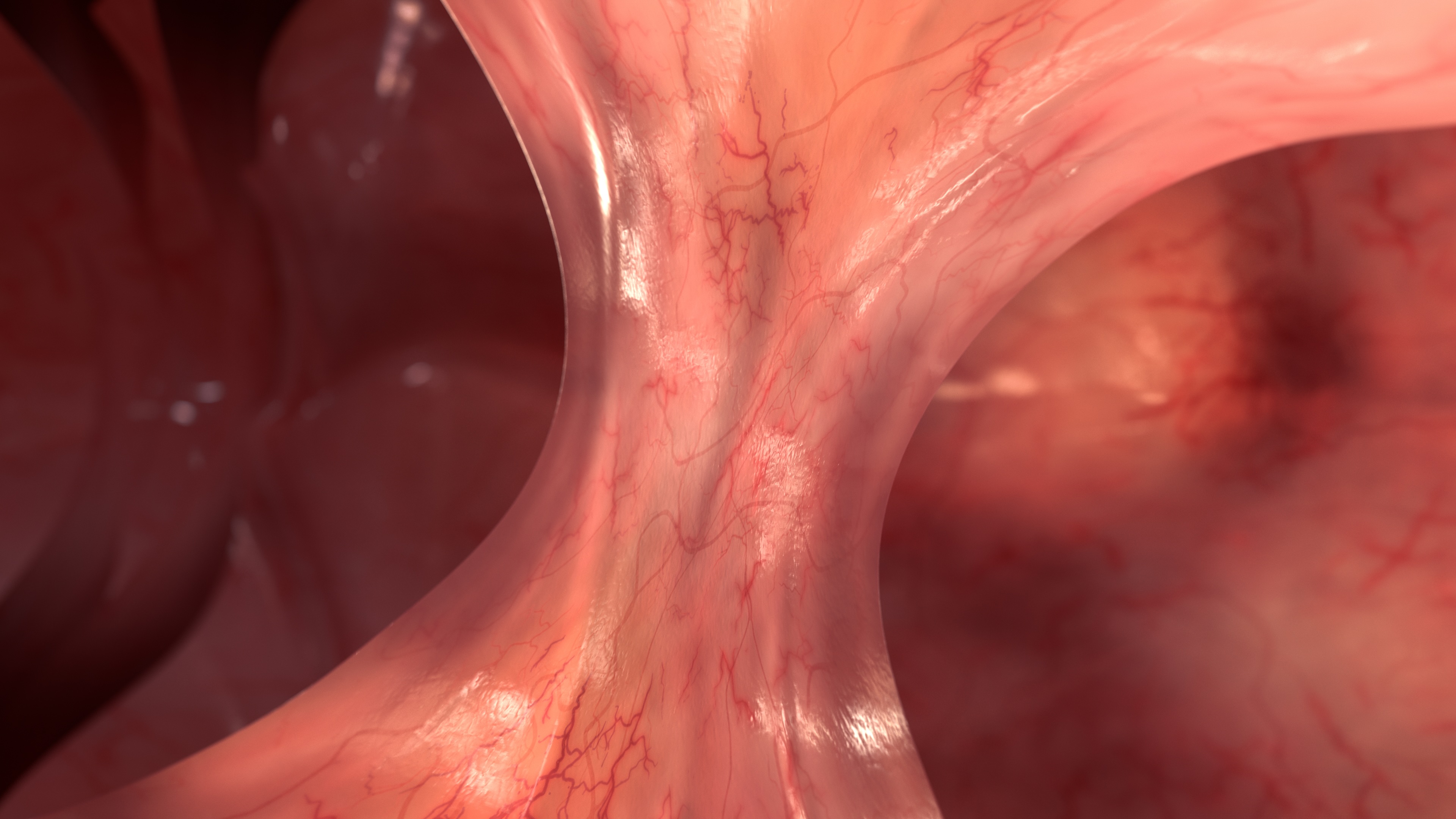 Image of Adhesion