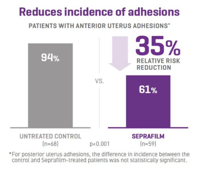 figure 1. Seprafilm Adhesion Barrier Reduces the Incidence of Adhesions Following Myomectomy3