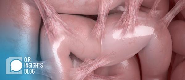 Adhesions and Chronic Pain